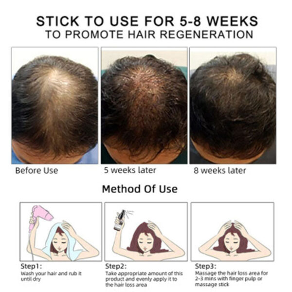 ⁦Hair Growth Oil Hair Growth Oil Oem Hair Care Essential Oil⁩ - الصورة ⁦2⁩