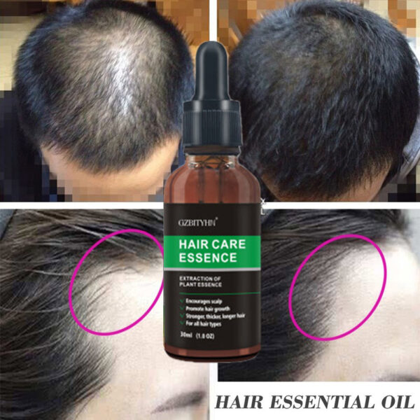 ⁦Hair Growth Oil Hair Growth Oil Oem Hair Care Essential Oil⁩ - الصورة ⁦6⁩